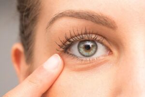 Bye to Dark Circles - Fashion Fiasca.
